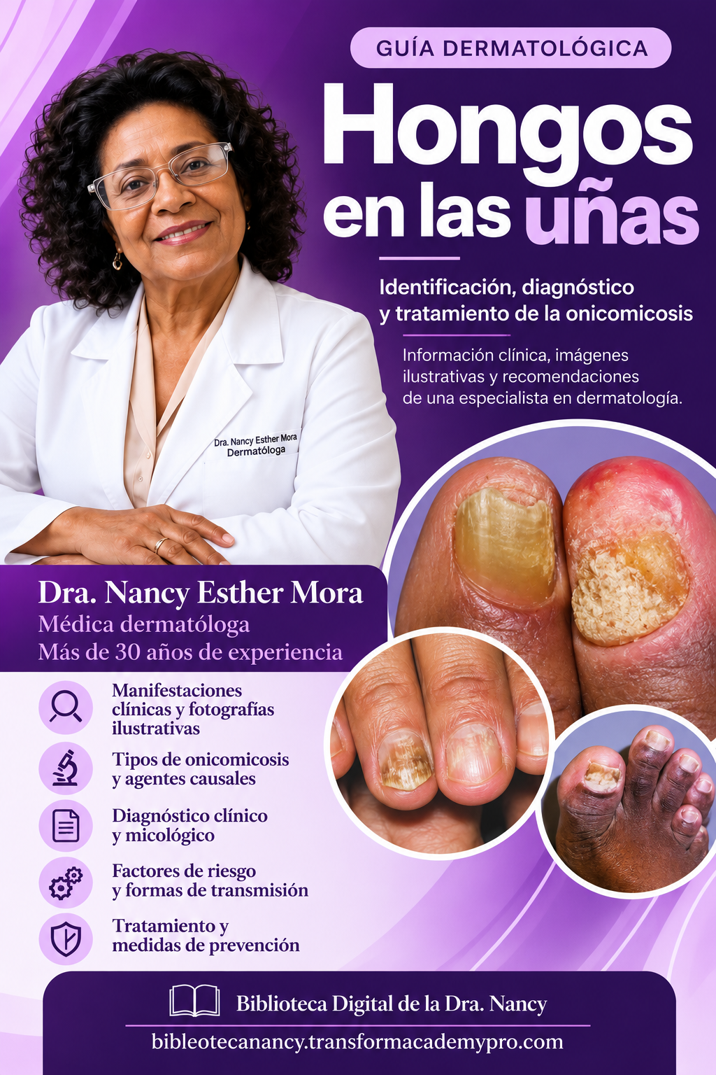 Hongos en las uñas